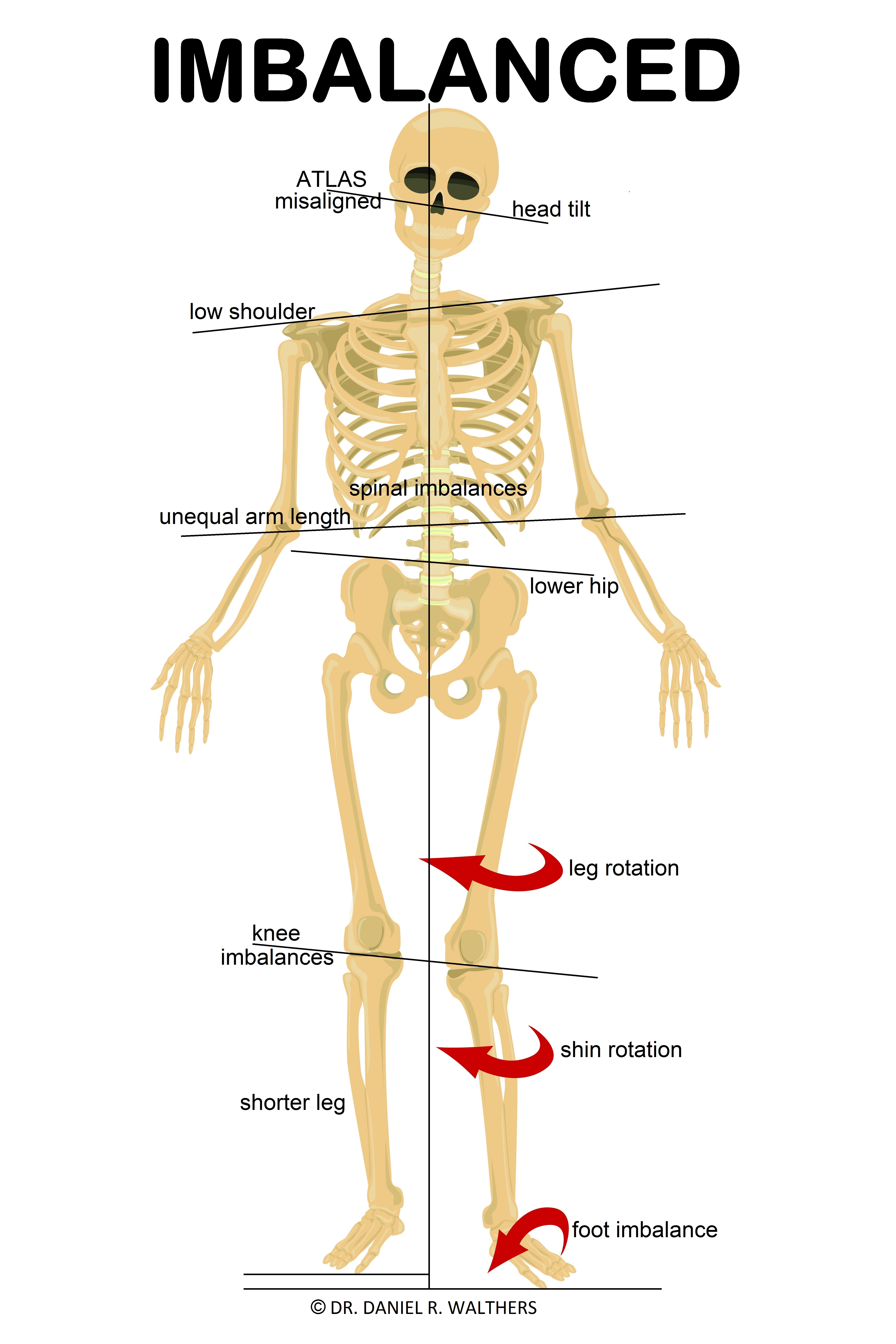 24X36 TAN skeleton IMBALANCED POSTER