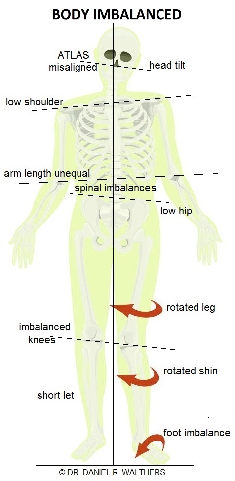 Image 2 Body Imbalanced