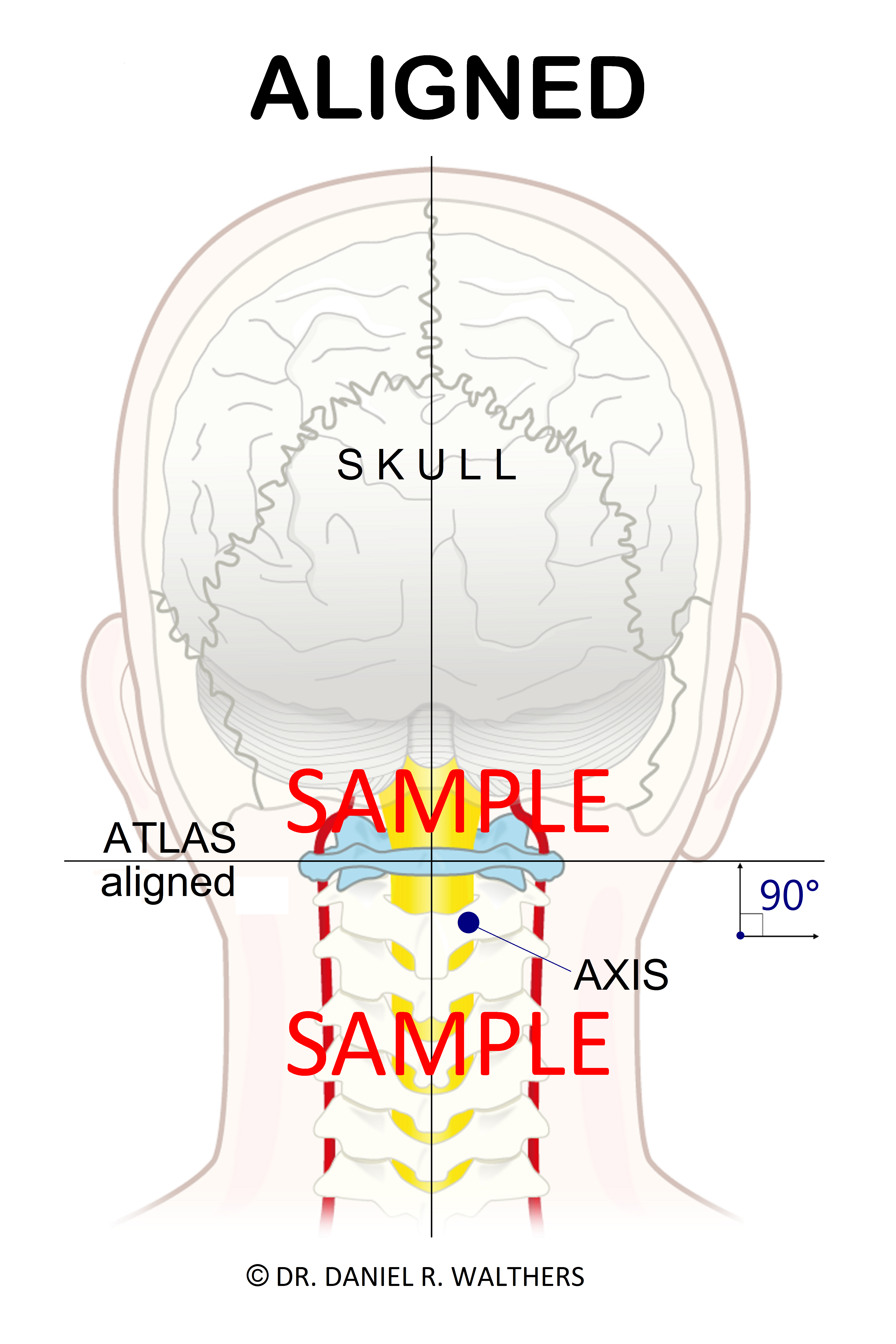 SAMPLE 24X36 ALIGNED ATLAS POSTER