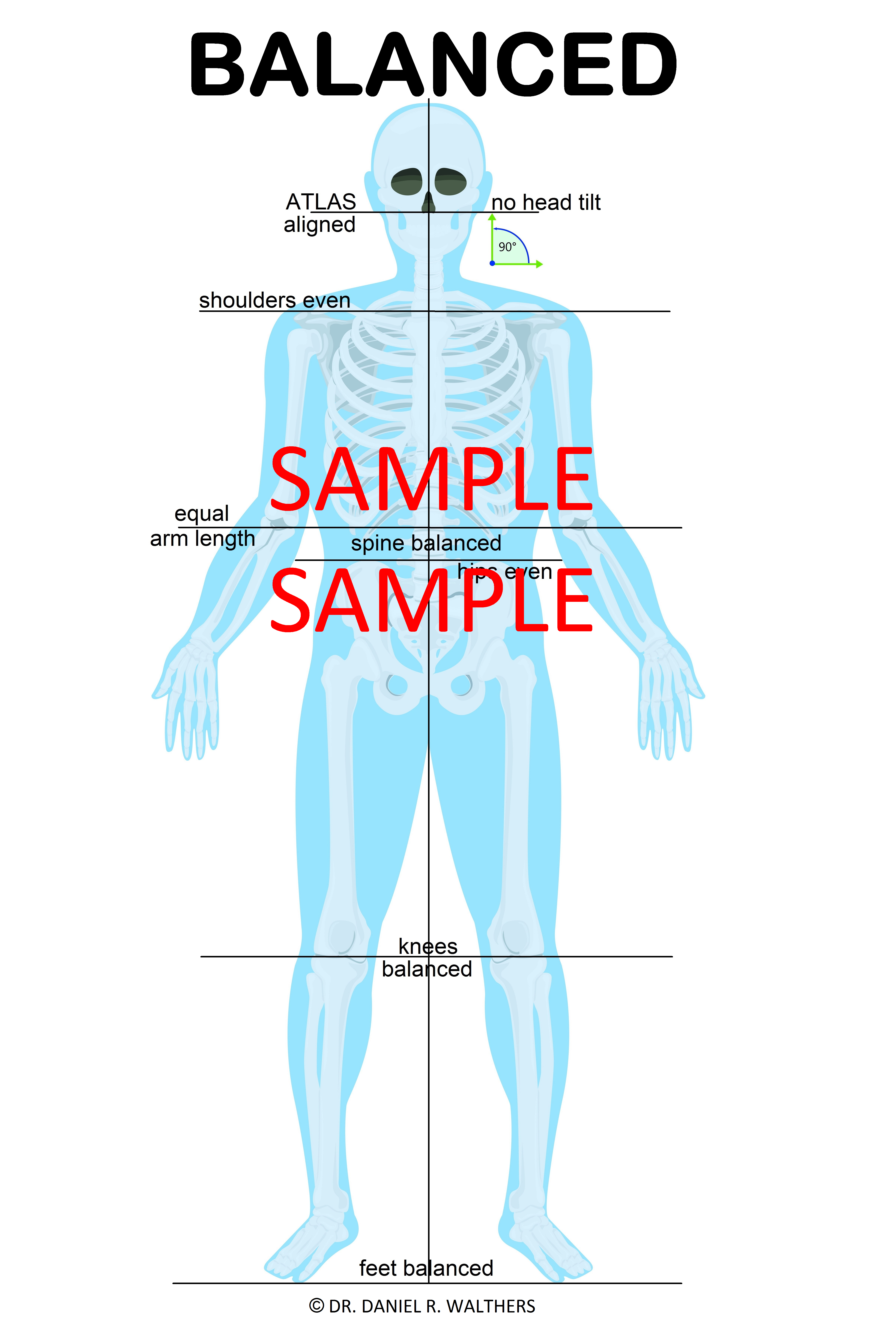 SAMPLE 24X36 COLORED blue skeleton BALANCED  POSTER