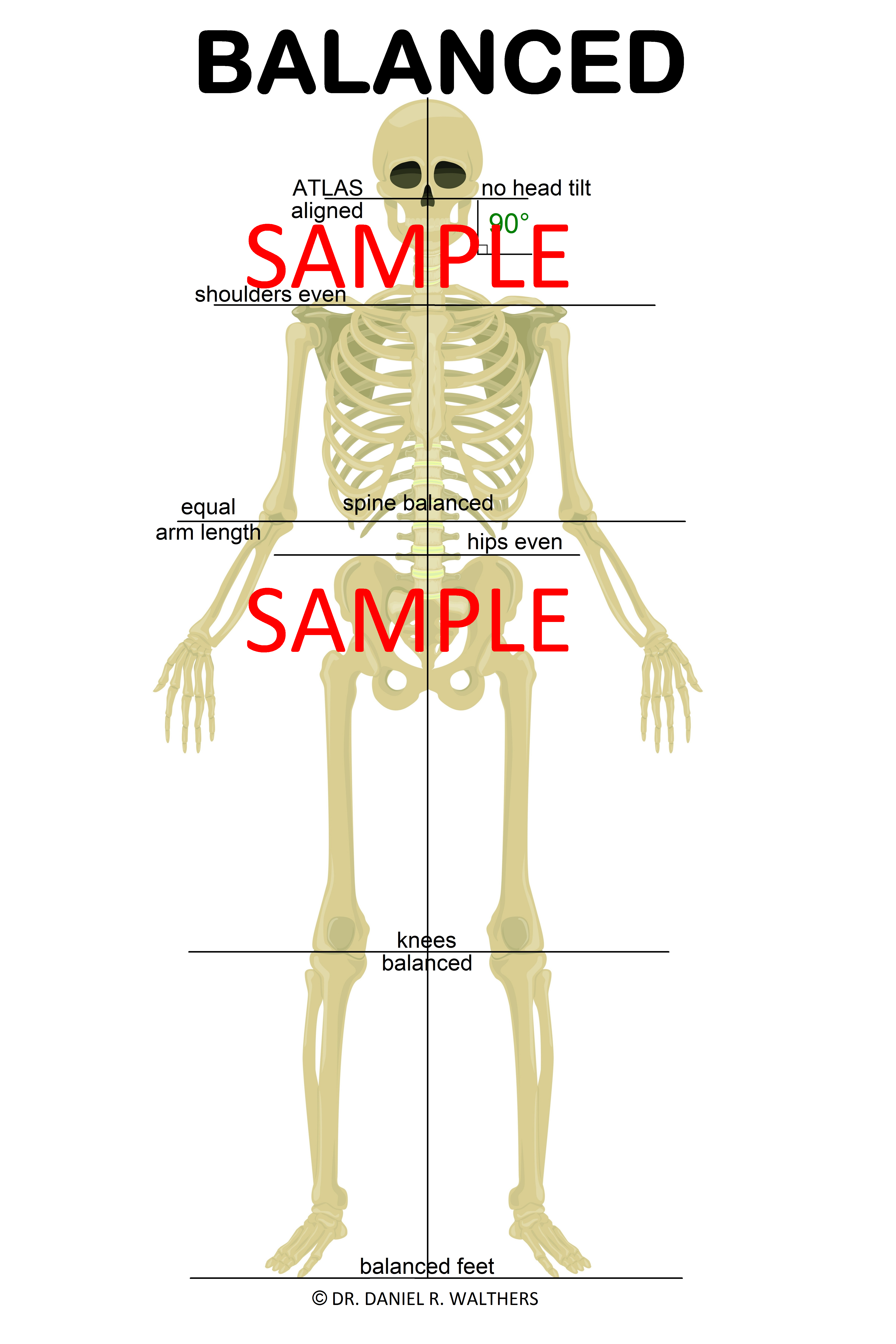 SAMPLE 24X36 GRAY skeleton BALANCED POSTER