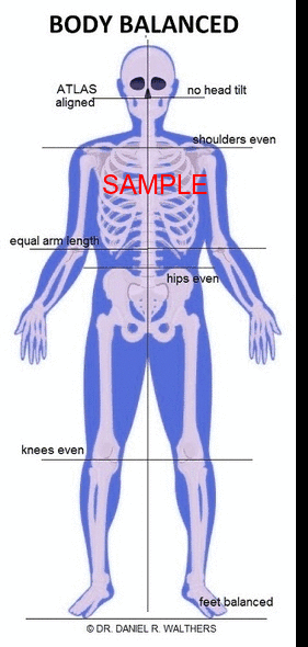 SAMPLE colored skeleton Balanced Imbalanced GIF