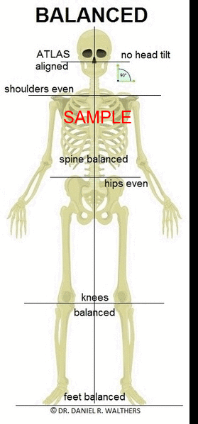 Sample GIF Balanced Imbalanced 1